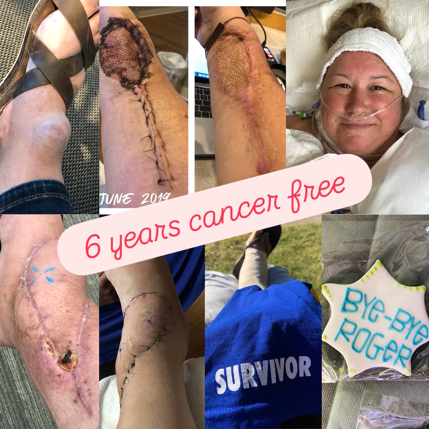 Today I stand in awe and gratitude—six years cancer free. 🙌 Every day since has felt like a gift I don’t take lightly.

I’m forever thankful for my friends, family, church family, and my Joy FM family (listeners included—you truly are my family!) who carried me when I was weary and kept breathing hope into my torn sails. Your love held me up.

I also owe a debt of gratitude to the incredible doctors, nurses, techs, and staff at @sitemancancercenter, @washumedortho, and MOBAP Wound Center. Your hands and hearts made it possible for me to be here today, celebrating this milestone.

I don’t just celebrate six years of healing—I celebrate every single person who walked with me, prayed for me, and believed alongside me. I’ll never stop giving thanks for you. 💕