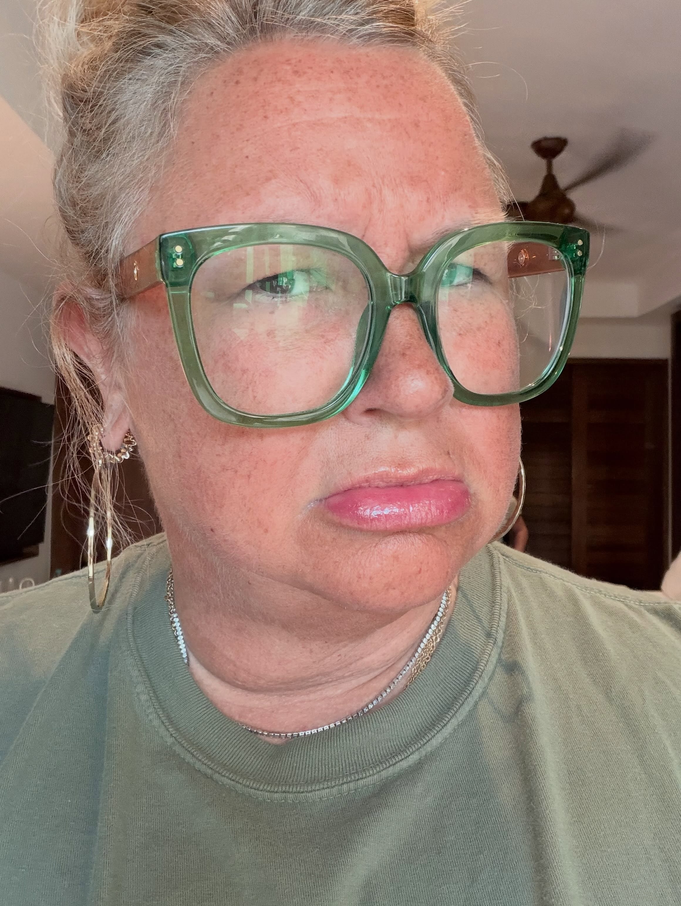 Sunburned lip, hallelujah.